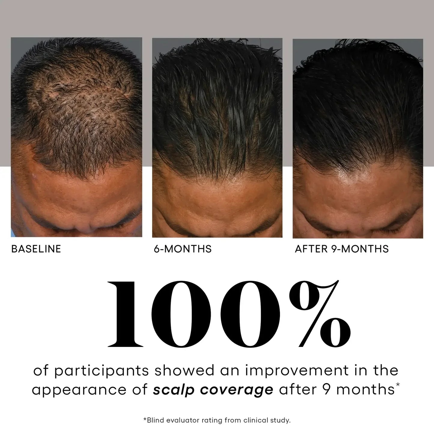 HAIR Serum Targeted Renewal for the Scalp and Hair