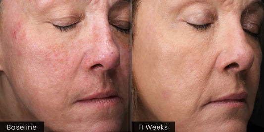 Plated Intense Serum in San Diego/Skin and Brows By Tina